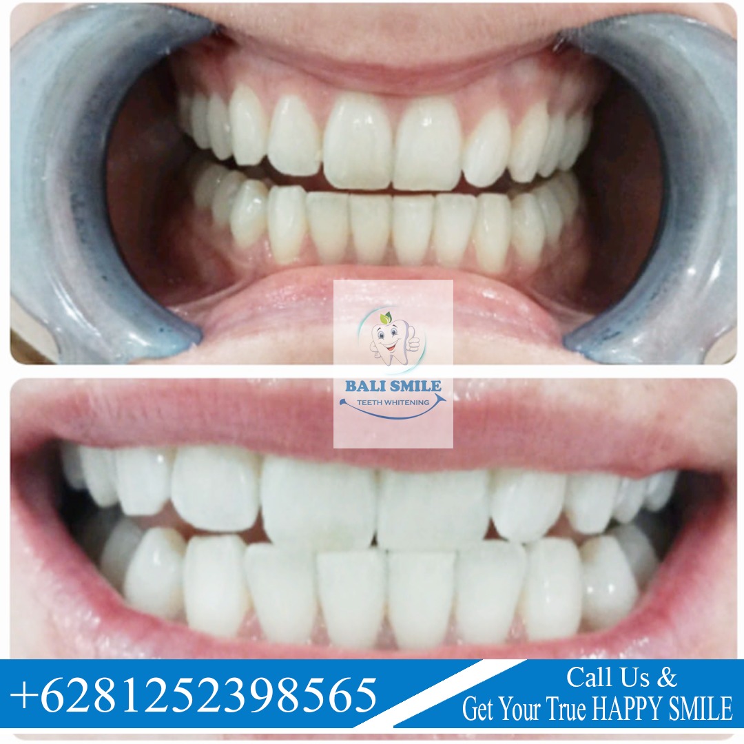 WhatsApp Image 2023-03-08 at 08.34.30